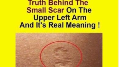 Photo of Do You Know The Real Significance Of The Small Scar